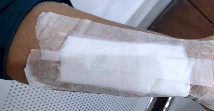 ভেঙ্গে পড়ল বিএনপির বিজয় দিবসের কনসার্টের মঞ্চ